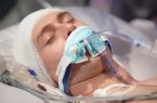 ضربه به سر ممکن است سلامت روده را مختل کند ضربه به سر ممکن است سلامت روده را مختل کند
