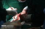 تشریح مهم ترین چالش های پیوند ریه در ایران تشریح مهم ترین چالش های پیوند ریه در ایران
