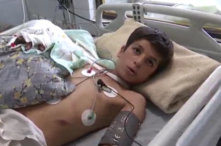 یک جراحی کمنظیر در بروجرد؛ دست قطعشده نوجوان دوباره به بدن بازگشت یک جراحی کمنظیر در بروجرد؛ دست قطعشده نوجوان دوباره به بدن بازگشت